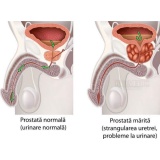 Complex Naturist Avansat pentruTractul Urinar Masculin - Prostata