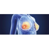 Pachet 3x Graviola Annona Muricata Antitumoral Anticancer 180 capsule Livrare Gratuita Prospect