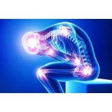 Pechet Naturist Avansat Neuromodulator Sistem Neuromuscular
