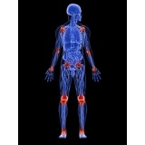 MenaQ7 MK-7 Vitamina K2 Menachinona-7 100 mcg cu Ascorbyl Palmitate 60 Vcaps Osteoporoza, Artrita Reumatoida, Scleroza Multipla, Parkinson