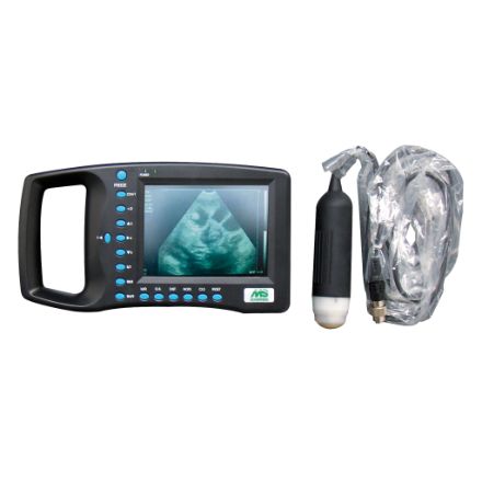 Multiscan digital