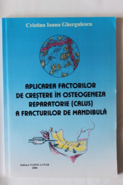 Cristina Ioana Ghergulescu - Aplicarea factorilor de crestere in osteogeneza reparatorie (calus) a fracturilor de mandibula