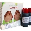 GAVEZ KOMPLET ZA ČUKLJEVE OD GAVEZA
