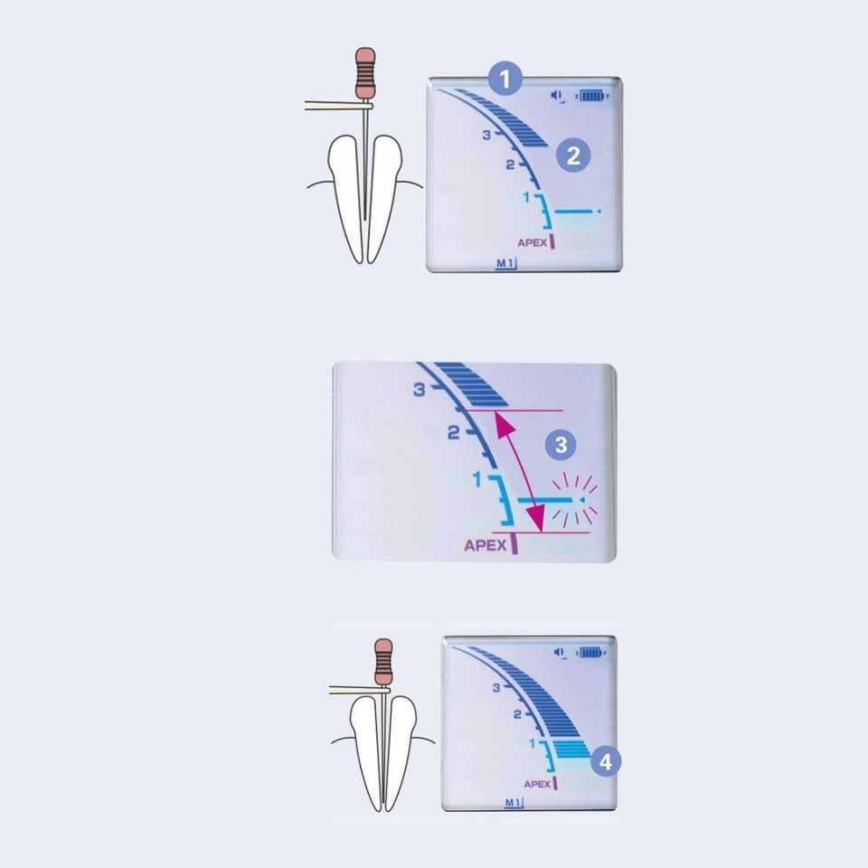 Cumpara acum Apex Locator cu Motor ENDO Dentaport ZX OTR la cel mai bun pret!