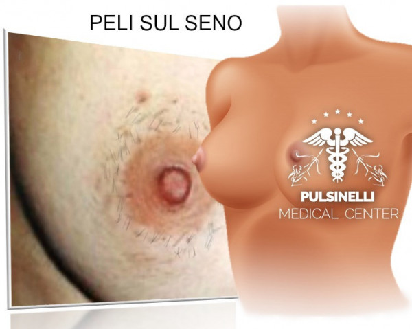laser peli seno