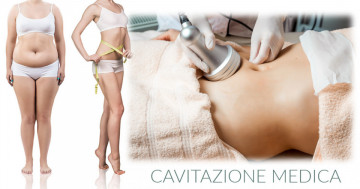 CAVITAZIONE MEDICA L’ALTERNATIVA ALLA LIPOSUZIONE