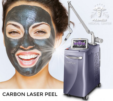 LASER CARBON PEEL