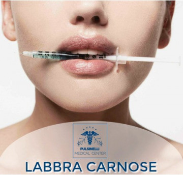 IL FILLER PER LABBRA PIU’ CARNOSE E RIMODELLATE