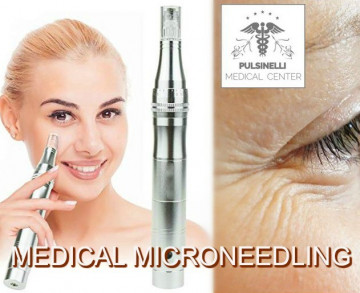 MEDICAL MICRONEEDLING PER ELIMINARE LE RUGHE DEGLI OCCHI