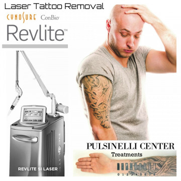 SEI PENTITO DEL TUO TATUAGGIO? CON REVLITE TROVERAI LA SOLUZIONE!