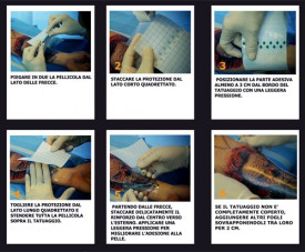 Dermalize Protective Tattoo Film Rotolo