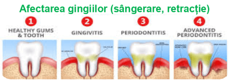 Probleme ale gingiilor