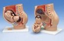 Mulaj pelvis gestant