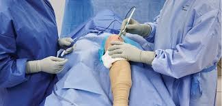 CAMPURI STERILE