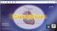CARDIOSCAN 12 - SOFTWARE de analiza pentru monitorizarea Holter ECG DMS
