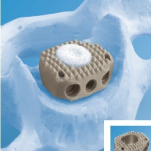 BIA, Cage vertebral cervical din PEEK