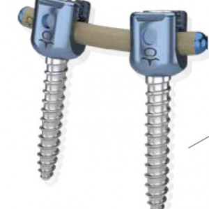 Suruburi fixare transpediculara, poliaxiale