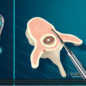 PediGuard Curbat