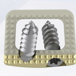 TITANOPEEK - Cage Vertebral Cervical cu suruburi de prindere si profil anatomic