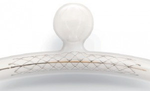 ACCLINO, stent pentru tratamentul anevrismelor intracraniene
