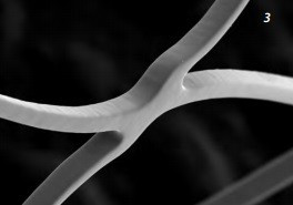 CREDO, Stent flexibil din Nitinol cu ​​auto-expandare pentru tratamentul stenozei intracraniene