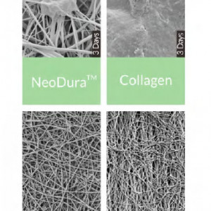 Substituent dural NeoDura Enlife