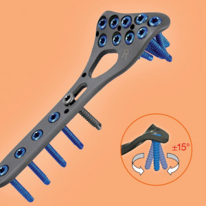 Placa de Radius Distal