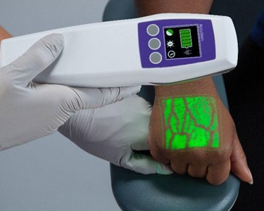 Vein Finder | AccuVein AV500 Vein Viewing System