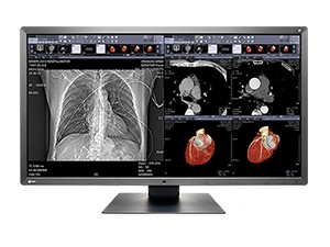 MX315 W medicinski monitor