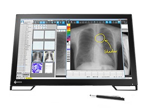 MS236 MT Medicinski monitor