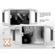 Portabl X-Ray X Avier rendgen sistem