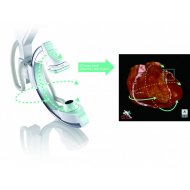 Shimadzu Trinias F8/C8, kardioloski sistem