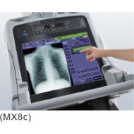 MX8 mobilni rendgen aparat
