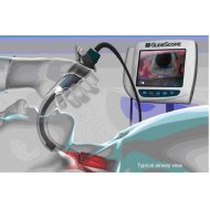Digitalni Laringoskop Medicinski Laringoskop