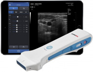 New SONON 300L Wireless, App-based Ultrasound System