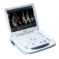 Fokuda portabilni ultrazvuk-超音波画像診断装置 UF-760AG+ PaoLus+