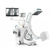 Solo FD Mobile C -arm