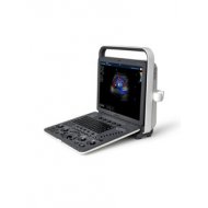SonoScape S8-Exp Portabilni Ultrazvucni Aparat