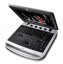 Chison Sonobook9 portable ultrasound machine