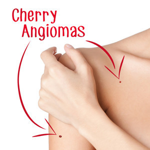 BLEND ANGIOMI 30ML