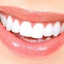 Sbiancamento Dentale Professionale (Sessione 15/20 min)